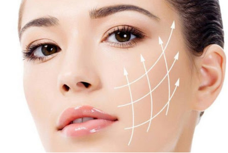 Liệu pháp căng da mặt có tốt và an toàn không?